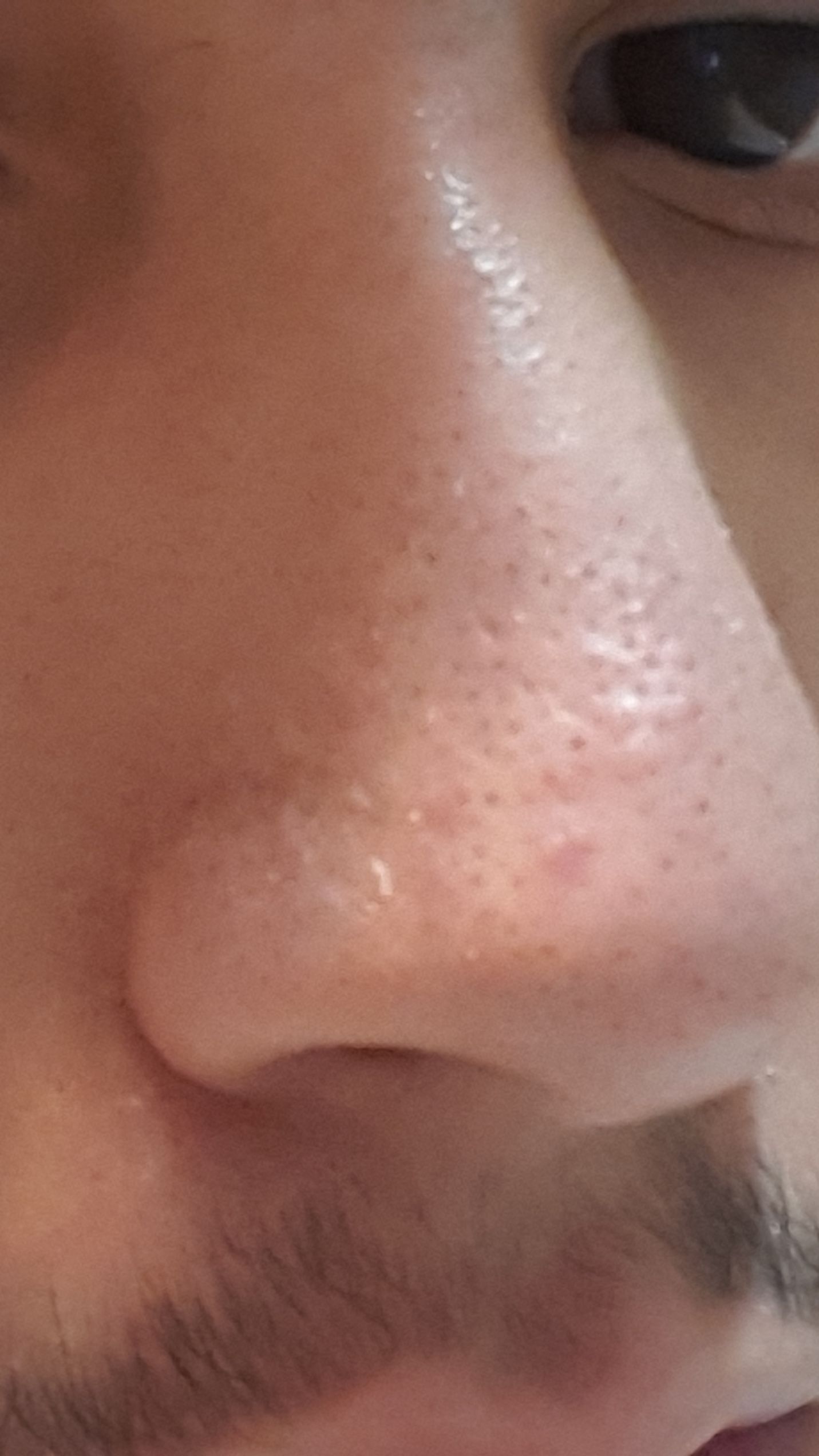 nose.jpg